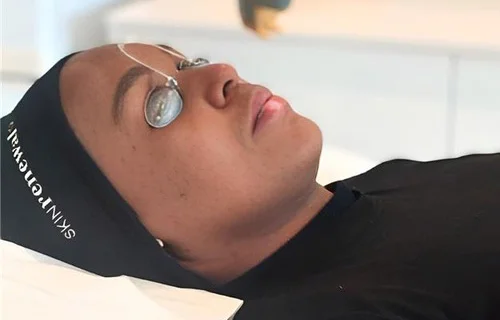 Skin Renewal Morningside Sandton