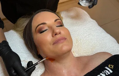 Skin Renewal Century City