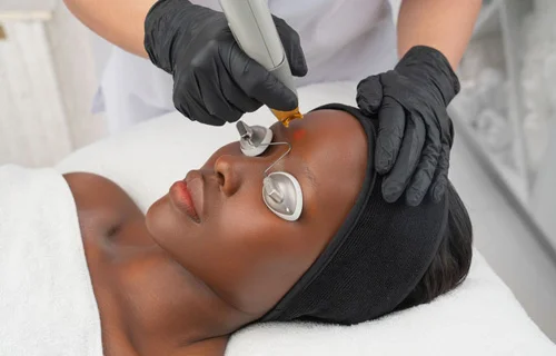 Skin Renewal Rosebank